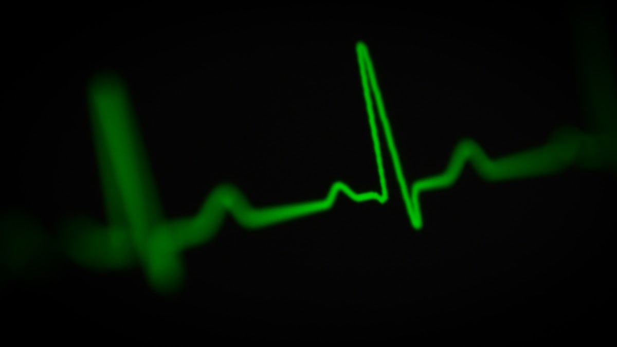 a green heart beat on a black background